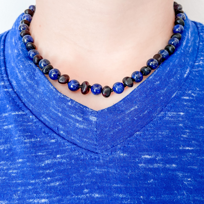 Baltic Amber Necklace - 12.5 Inch Baltic Amber Necklace Polished Black Cherry & Lapis Lazuli