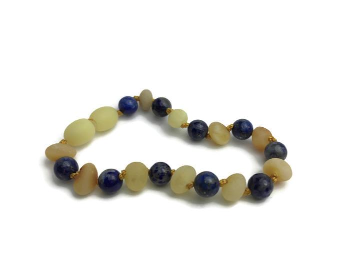 Baltic Amber Bracelet - ADHD Arthritis Carpal Tunnel Raw Milk Lapis Amber Bracelet