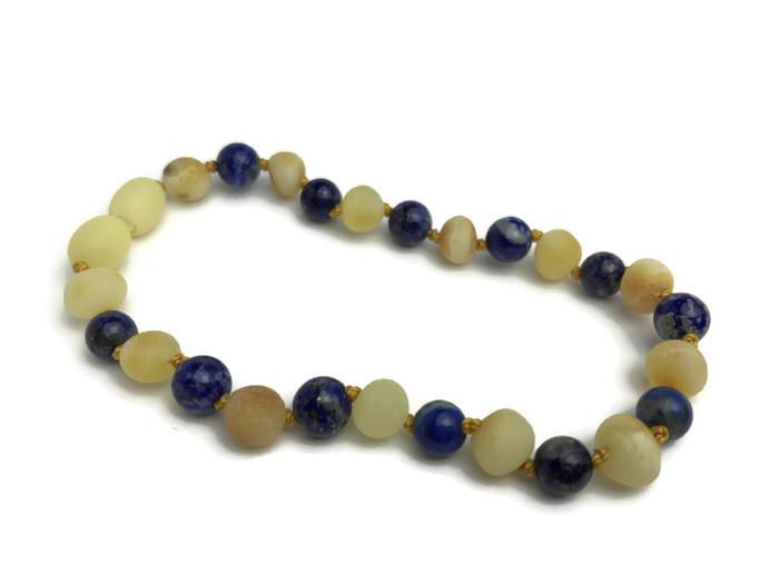 Baltic Amber Bracelet - ADHD Arthritis Carpal Tunnel Raw Milk Lapis Amber Bracelet