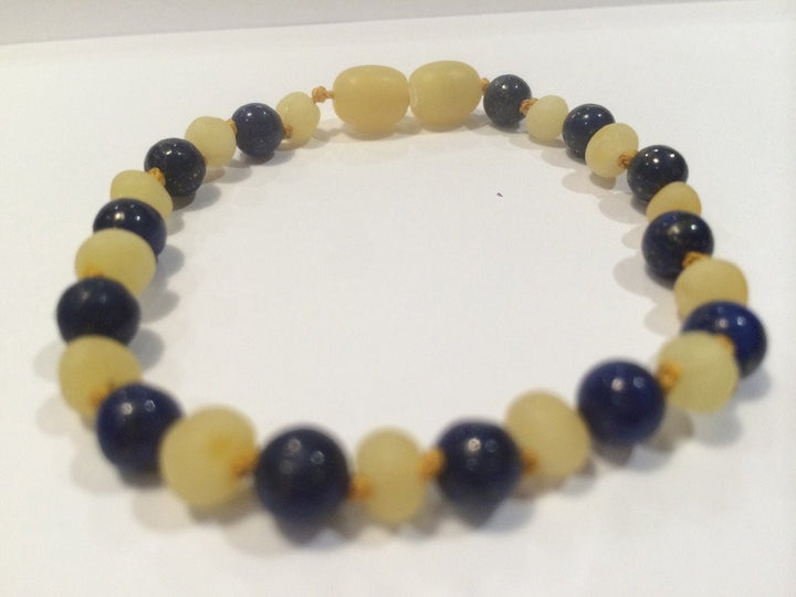 Baltic Amber Bracelet - ADHD Arthritis Carpal Tunnel Raw Milk Lapis Amber Bracelet