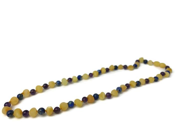 Baltic Amber Necklace - ADHD Anxiety Anger Stress Raw Milk Baltic Amber Lapis Lazuli 17 19 22