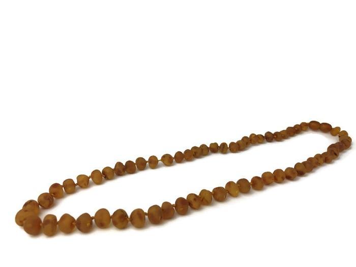 Baltic Amber Necklace - Adult Baltic Amber Arthritis Carpal Tunnel Sciatica Migraine Back Pain