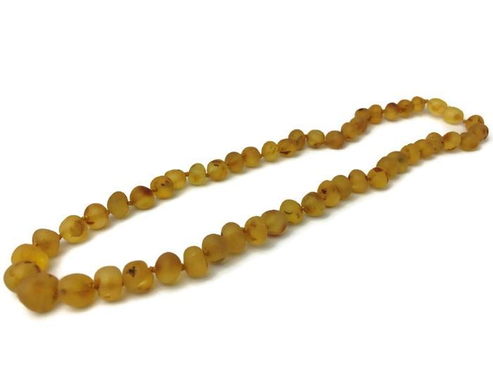 Raw Unpolished 17 Inch Honey Baltic Amber Necklace For Big Kid, Child, Teen, Or Adult