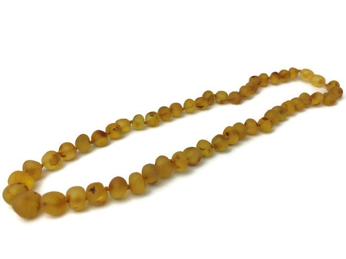 Raw Unpolished Honey Baltic Amber Necklace For Big Kid, Child, Or Adult